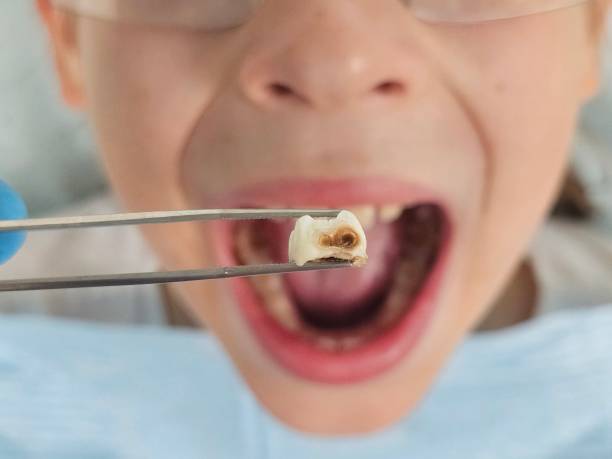Best Walk-In Emergency Dentist in Town Creek, AL
